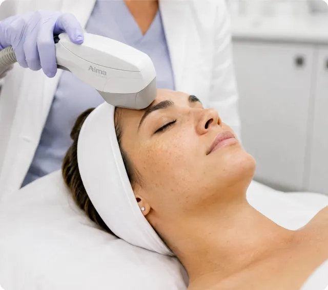 Fotorejuvenecimiento con IPL - Clínica María 3 Marbella